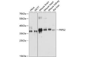 Western blot analysis of extracts of various cell lines, using PRPS2 antibody (ABIN6132521, ABIN6146272, ABIN6146274 and ABIN6216352) at 1:3000 dilution. (PRPS2 antibody  (AA 1-240))