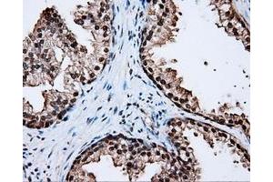 Immunohistochemical staining of paraffin-embedded liver tissue using anti-LTA4H mouse monoclonal antibody. (LTA4H antibody)