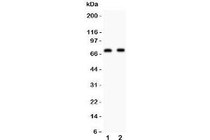 Western blot testing of Numb antibody and Lane 1: human U87;  2: mouse Neuro-2a lysate.