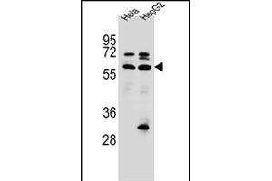 SEPN1 Antibody (C-term) (ABIN656385 and ABIN2845680) western blot analysis in Hela,HepG2 cell line lysates (35 μg/lane). (SEPN1 antibody  (C-Term))