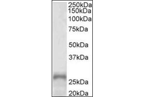 Western Blotting (WB) image for anti-Paired-Like Homeobox 2a (PHOX2A) (AA 165-179), (Internal Region) antibody (ABIN1108647) (PHOX2A antibody  (Internal Region))