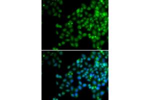Immunofluorescence analysis of HeLa cell using EPC1 antibody. (EPC1 antibody)