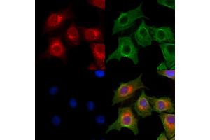 ABIN7094414 and ABIN7098461 staining HepG2 cells by IF/ICC. (OGDHL antibody  (Internal Region))