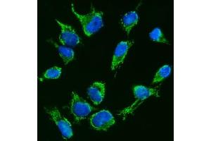 IF analysis of TFEB using anti-TFEB antibody (ABIN7600648). (TFEB antibody  (AA 214-326))