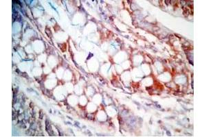 Human colon tissue was stained by Rabbit Anti-CCK (26-33)  (Human,Rat) Antibody (Cholecystokinin antibody  (non-sulfated))