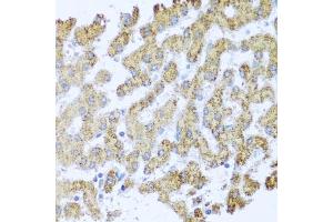 Immunohistochemistry of paraffin-embedded human liver using MOK antibody (ABIN3022550, ABIN3022551, ABIN3022552 and ABIN6218895) at dilution of 1:100 (40x lens). (MOK antibody  (AA 1-230))