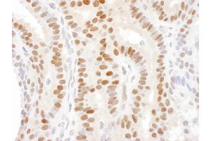 anti-Dachshund 1 (DACH1) (AA 720-740) antibody