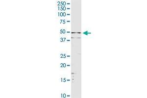 SERPINA3 MaxPab rabbit polyclonal antibody. (SERPINA3 antibody  (AA 1-423))