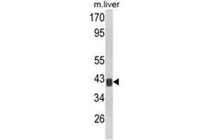 Western blot analysis of TOB1 Antibody (N-term) Cat. (Protein Tob1 (TOB1) (AA 61-91), (N-Term) antibody)