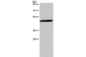 Western Blot analysis of 293T cell using Glucagon Receptor Polyclonal Antibody at dilution of 1:200 (Glucagon Receptor antibody)