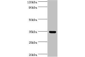Western blot All lanes: Arginase-1 antibody at 8 μg/mL + Mouse liver tissue Secondary Goat polyclonal to rabbit IgG at 1/10000 dilution Predicted band size: 35, 36, 26 kDa Observed band size: 35 kDa (Liver Arginase antibody  (AA 1-322))