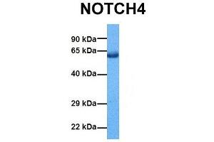 Host:  Rabbit  Target Name:  NOTCH4  Sample Tissue:  Human Lung Tumor  Antibody Dilution:  1. (NOTCH4 antibody  (Middle Region))