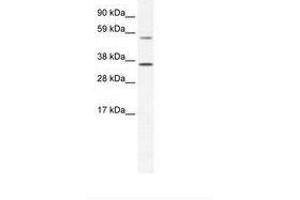 Image no. 1 for anti-Mesoderm Posterior 2 Homolog (Mesp2) (AA 299-348) antibody (ABIN202356) (Mesp2 antibody  (AA 299-348))