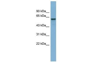 Dynactin 4 antibody used at 1 ug/ml to detect target protein. (Dynactin 4 antibody)