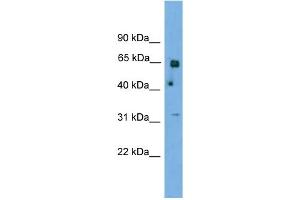 WB Suggested Anti-PNKP Antibody Titration: 1. (PNKP antibody  (N-Term))