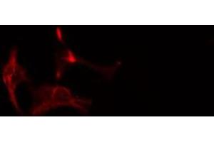 ABIN6275873 staining HepG2 cells by IF/ICC. (HMMR antibody  (Internal Region))