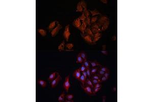 Immunofluorescence analysis of U-2 OS cells using B Polyclonal Antibody (ABIN6131247, ABIN6137447, ABIN6137448 and ABIN6222194) at dilution of 1:100 (40x lens). (BAP1 antibody  (AA 460-729))