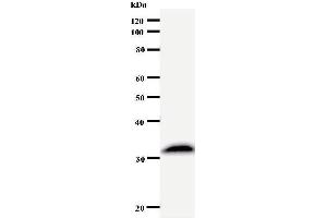 Western Blotting (WB) image for anti-Suppressor of Ty 4 Homolog 1 (SUPT4H1) antibody (ABIN932460) (SUPT4H antibody)
