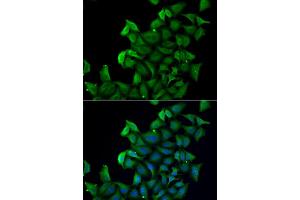Immunofluorescence analysis of A549 cell using FABP5 antibody. (FABP5 antibody)