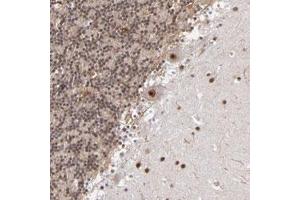 Immunohistochemical staining of human cerebellum with MLLT3 polyclonal antibody  shows strong nuclear positivity in purkinje cells at 1:50-1:200 dilution. (AF9 antibody)