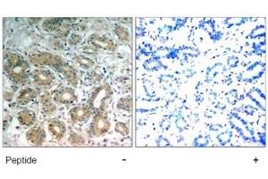 Image no. 1 for anti-Protein tyrosine Phosphatase, Non-Receptor Type 11 (PTPN11) (Tyr542) antibody (ABIN197594) (PTPN11 antibody  (Tyr542))