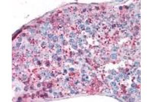 Immunohistochemistry (IHC) image for anti-Nuclear Receptor Subfamily 5, Group A, Member 1 (NR5A1) (C-Term) antibody (ABIN2469417)