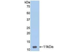 Detection of Recombinant DEFb1, Mouse using Polyclonal Antibody to Defensin Beta 1 (DEFb1)