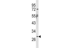 Western blot analysis of IL-1B antibody and NCI-H460 lysate. (IL-1 beta antibody  (AA 148-174))