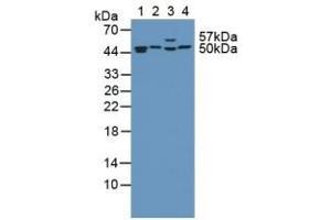 Detection of PSMC4 in Human Kidney Tissue using Polyclonal Antibody to Proteasome 26S Subunit, ATPase 4 (PSMC4) (PSMC4 antibody  (AA 1-418))