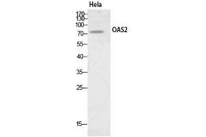 Western Blot (WB) analysis of HeLa cells using OAS2 Polyclonal Antibody.