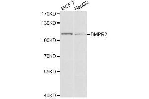 Western Blotting (WB) image for anti-Bone Morphogenetic Protein Receptor, Type II (serine/threonine Kinase) (BMPR2) antibody (ABIN1876867) (BMPR2 antibody)