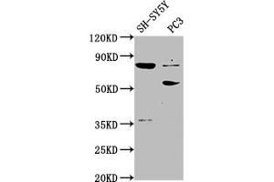 Western Blot Positive WB detected in: SH-SY5Y whole cell lysate, PC-3 whole cell lysate All lanes: ABLIM1 antibody at 1:2000 Secondary Goat polyclonal to rabbit IgG at 1/50000 dilution Predicted band size: 88, 82, 49, 47, 53, 85 kDa Observed band size: 88, 53 kDa