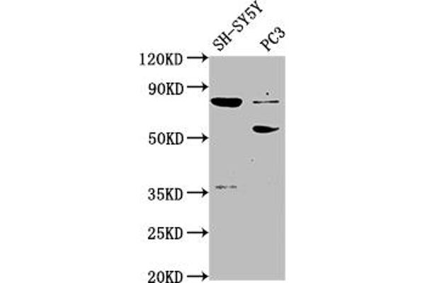 ABLIM1 anticorps  (AA 174-319)