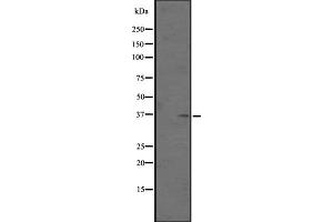 Western blot analysis of OR5AN1 expression in Human placenta tissue lysates ,The lane on the left is treated with the antigen-specific peptide. (OR5AN1 antibody  (Internal Region))