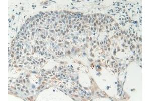 Immunohistochemistry (IHC) image for anti-High Mobility Group Box 1 (HMGB1) (AA 1-215) antibody (ABIN7431740)