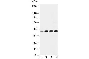 Western blot testing of IGFBP3 antibody and Lane 1:  293T;  2: MCF- 7;  3: A549;  4: SW620. (IGFBP3 antibody  (Middle Region))