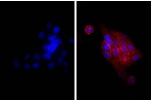 Human epithelial carcinoma cell line HEp-2 was stained with Mouse Anti-Human CD44-UNLB and DAPI. (Goat anti-Mouse IgG Antibody (TRITC))