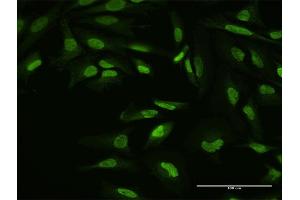 Immunofluorescence of purified MaxPab antibody to YY1 on HeLa cell.