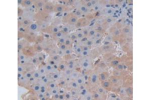 Used in DAB staining on fromalin fixed paraffin- embedded Kidney tissue (SERPINC1 antibody  (AA 1-259))