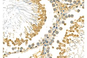 ABIN6266021 and ABIN6277022 at 1/100 staining Rat testis tissue by IHC-P.