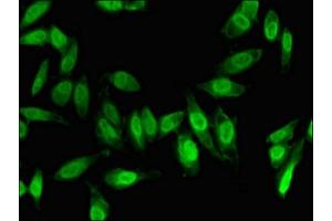 Immunofluorescent analysis of Hela cells using ABIN7153022 at dilution of 1:100 and Alexa Fluor 488-congugated AffiniPure Goat Anti-Rabbit IgG(H+L) (FOXC1 antibody  (AA 1-79))