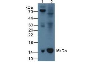Western Blotting (WB) image for anti-beta-2-Microglobulin (B2M) (AA 22-119) antibody (ABIN5662312)