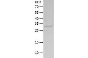 Western Blotting (WB) image for Calcineurin-Like phosphoesterase Domain Containing 1 (Cpped1) (AA 1-314) protein (His tag) (ABIN7288562) (Cpped1 Protein (AA 1-314) (His tag))