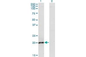 Western Blot analysis of IL6 expression in transfected 293T cell line by IL6 monoclonal antibody (M02), clone 2D12. (IL-6 antibody  (AA 29-212))