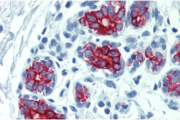 Keratin 7/17 antibody