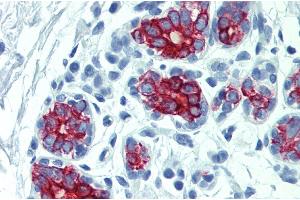 Immunohistochemistry staining of human breast (paraffin-embedded sections) with anti-cytokeratin 7+17. (Keratin 7/17 antibody)
