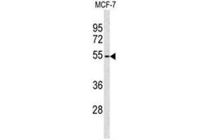 Western blot analysis of ADAMDEC1 Antibody (N-term) in MCF-7 cell line lysates (35 µg/lane). (ADAMDEC1 antibody  (N-Term))