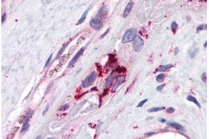 Human Placenta: Formalin-Fixed, Paraffin-Embedded (FFPE) (ADRP antibody  (AA 28-281))