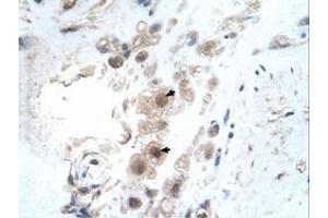 Immunohistochemical staining (Formalin-fixed paraffin-embedded sections) of human placenta with KIAA0494 polyclonal antibody  at 4-8 ug/mL working concentration. (KIAA0494 antibody  (N-Term))