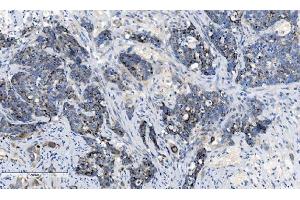 IHC analysis of CHCHD10 using anti-CHCHD10 antibody (ABIN7602507). (CHCHD10 antibody  (AA 80-142))